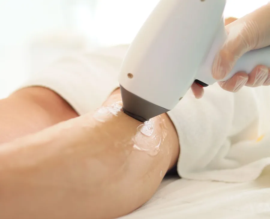 A white laser handpiece held against a client's skin on a treatment table