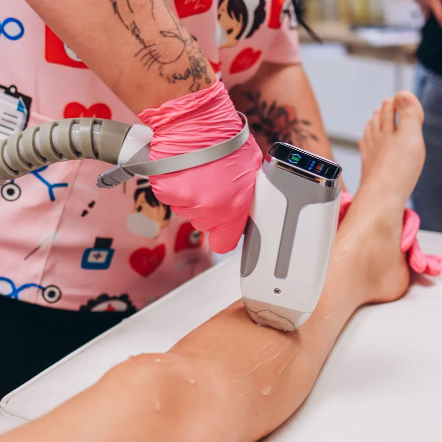 A gloved technician guiding a laser handpiece during a hair removal session